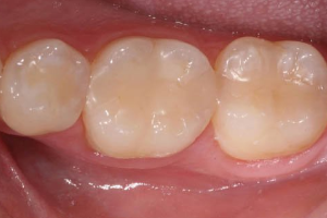 family dental clinic calgary